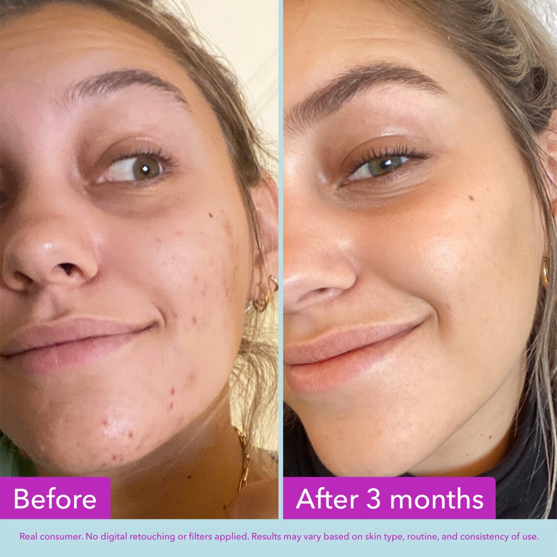 niacinamide-brightening-toner-v3 zb_p.jpg