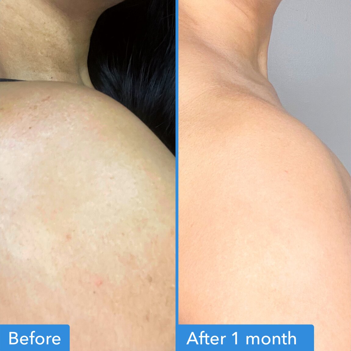 discoloration-correcting-body-treatment-w9 zb_p.jpg